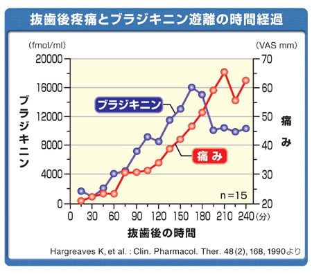 抜歯疼痛とブラジキニン遊離の時間経過